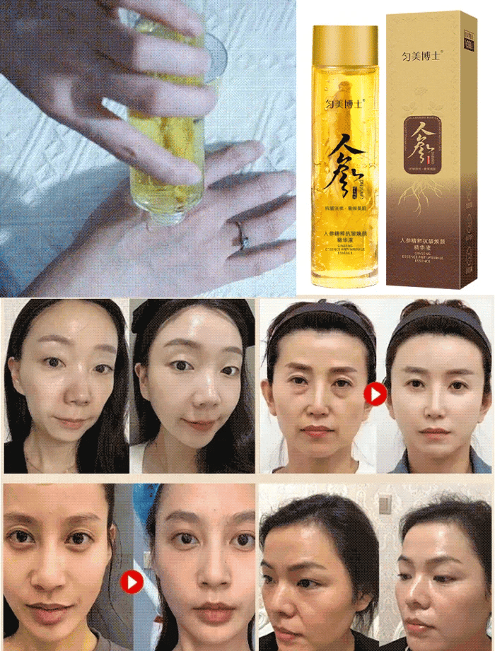 (Korea Import) Anti-Wrinkle Ginseng Essence Water