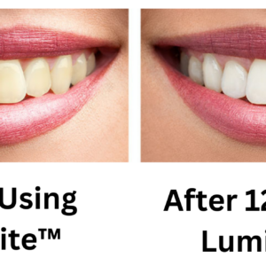 LumiBite