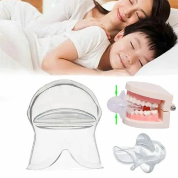 SleepEase Mouthguard