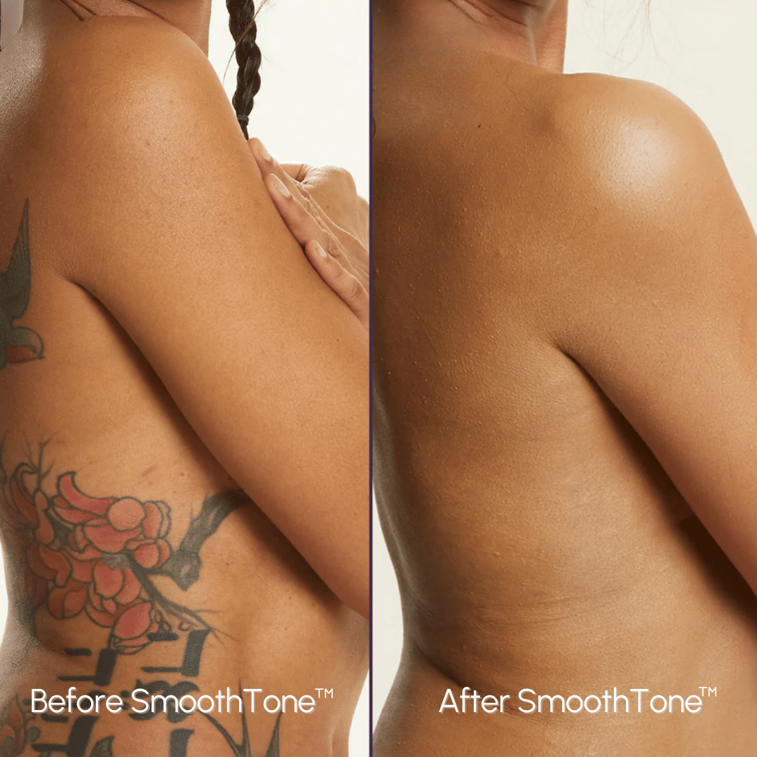 SmoothTone – Full Coverage Body Makeup