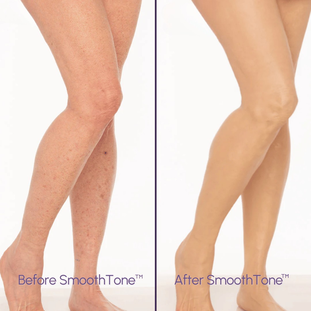 SmoothTone – Full Coverage Body Makeup