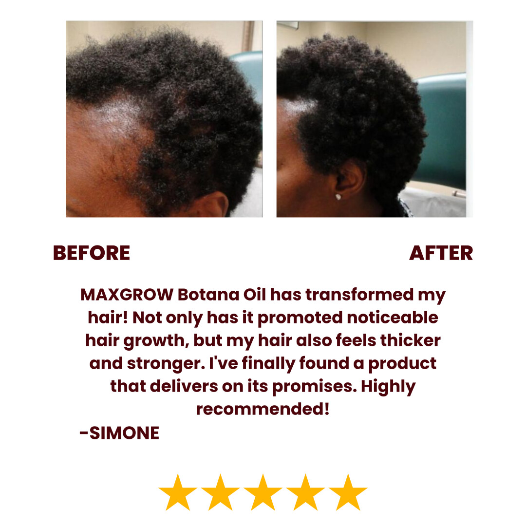 Batana Natural Hair Growth Oil