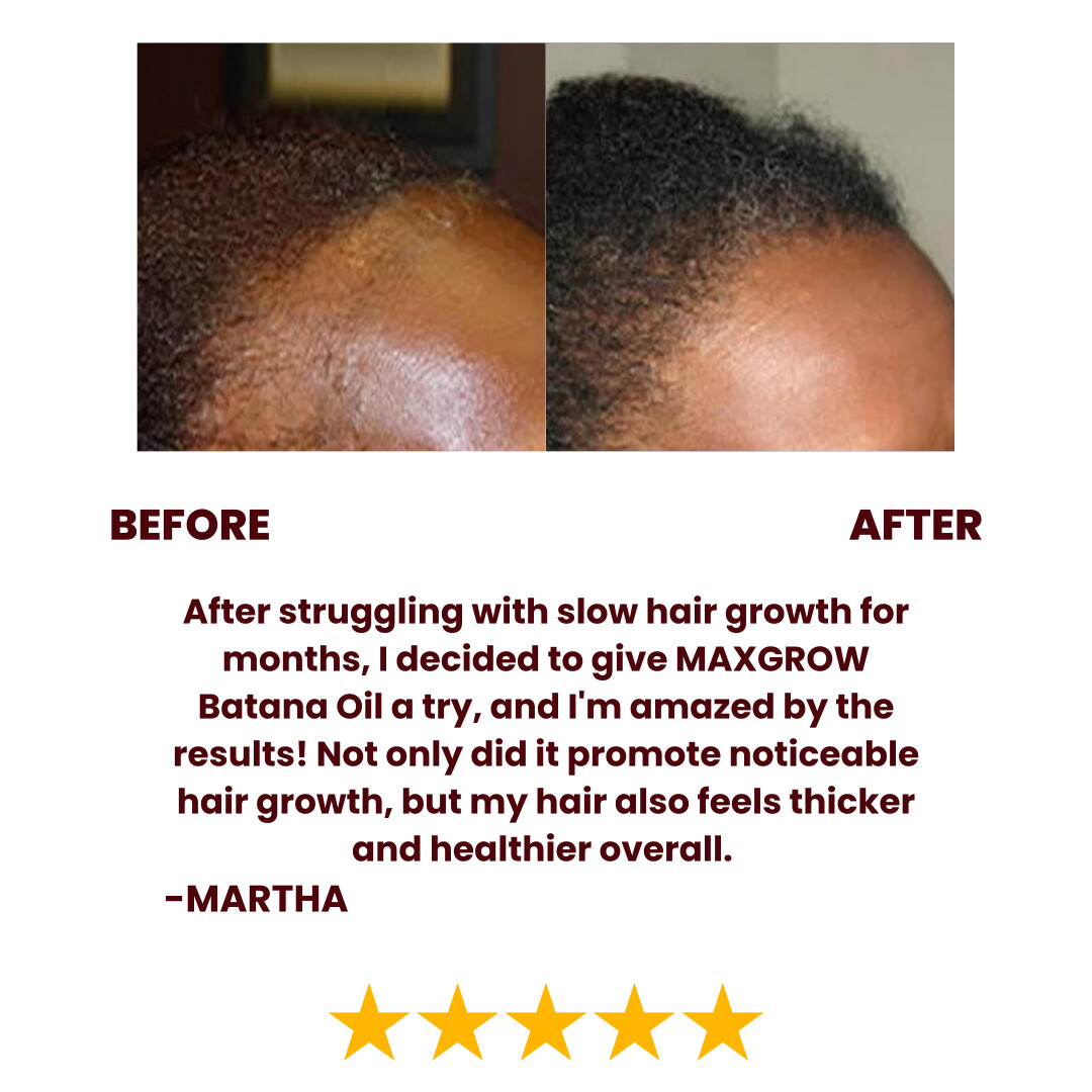 Batana Natural Hair Growth Oil