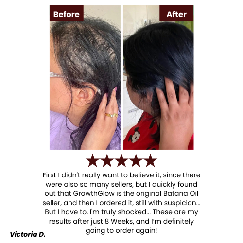 Vitalix Natural Hair Growth Oil